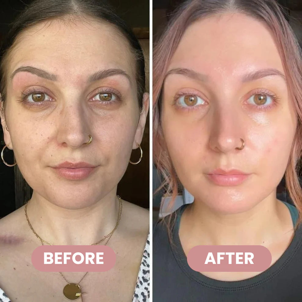 HydraFirm™ Wrinkle Repair Balm