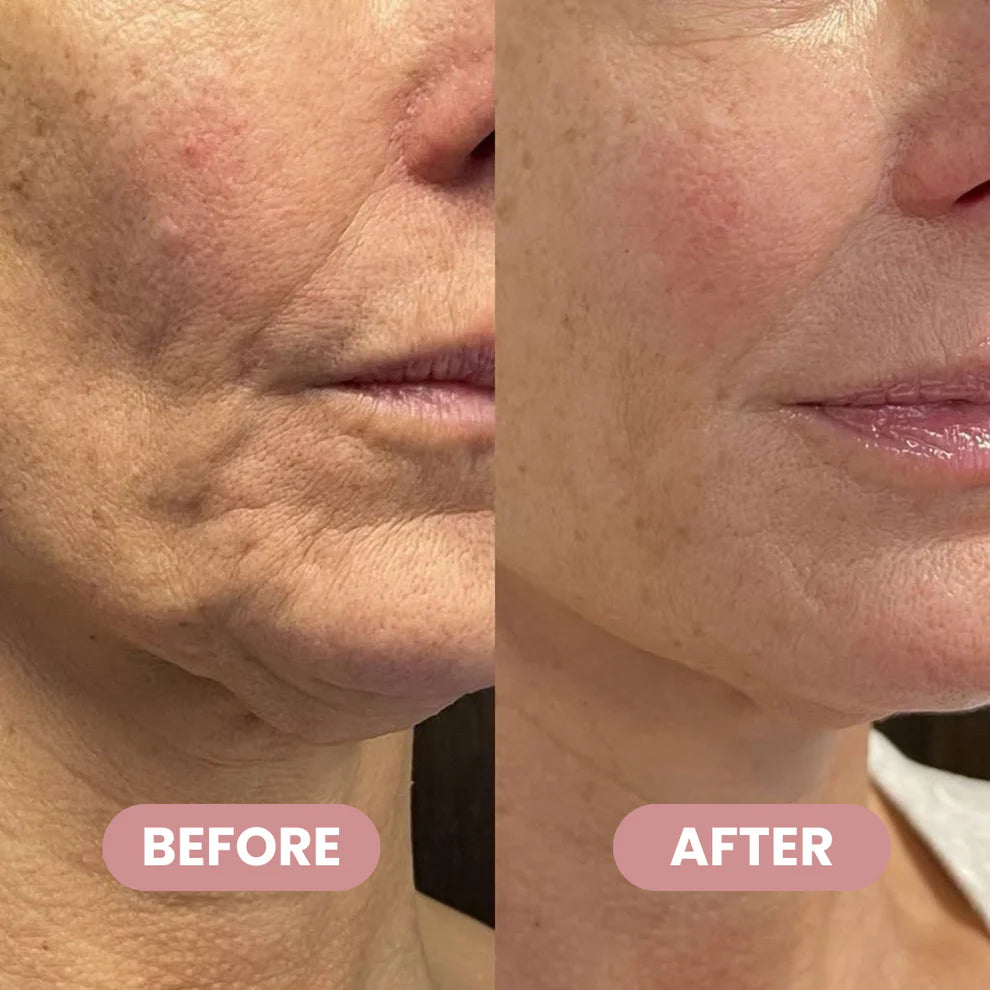 HydraFirm™ Wrinkle Repair Balm