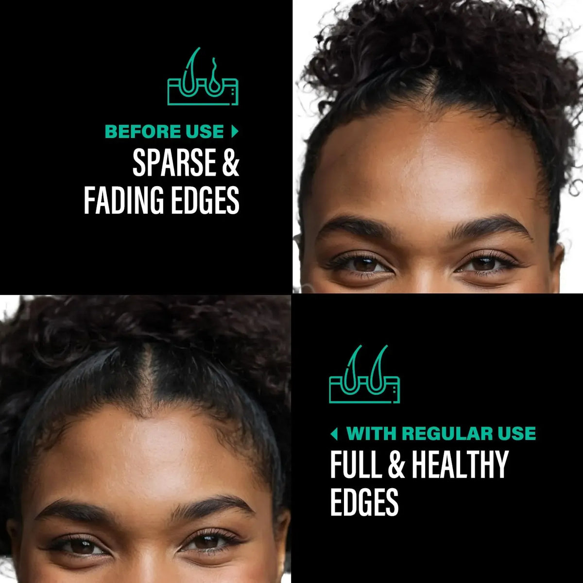 Batana Hair Growth Oil