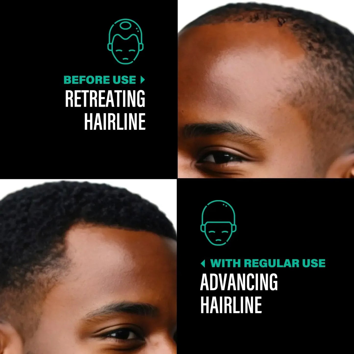 Batana Hair Growth Oil